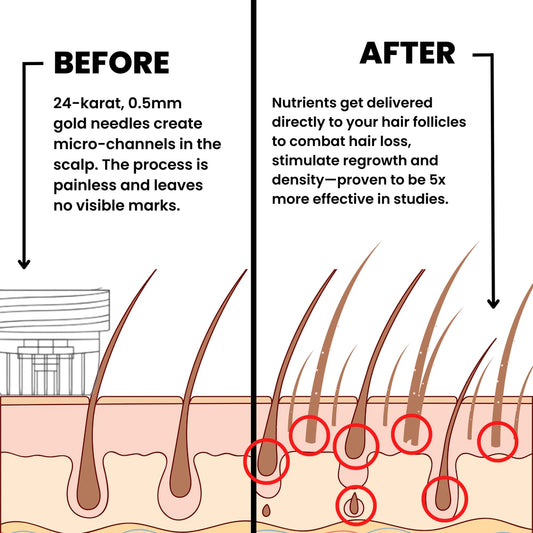 AlphaInfuse Hair Regrowth System